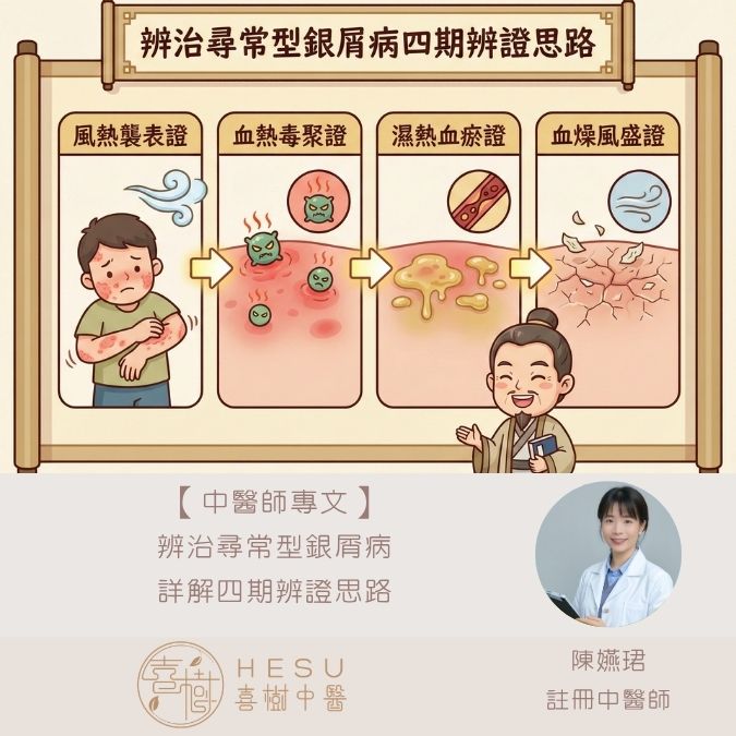 辨治尋常型銀屑病