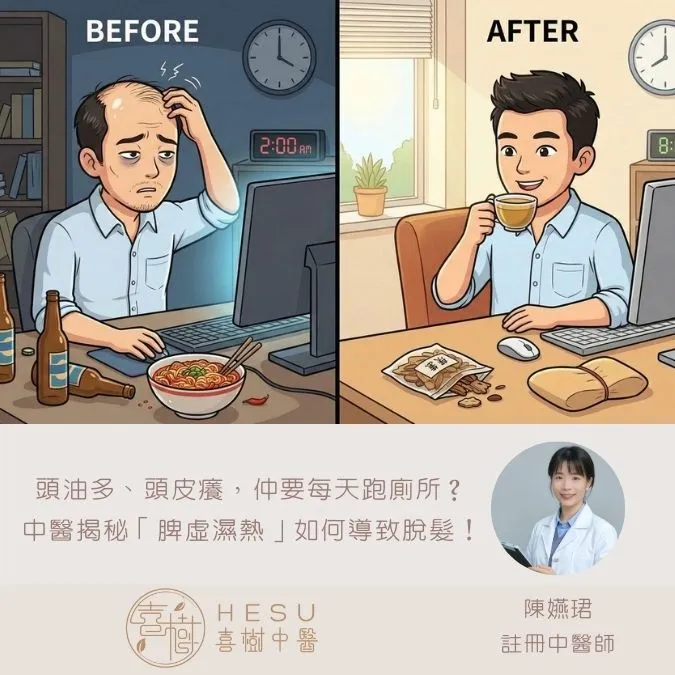 頭油多、頭皮癢，仲要每天跑廁所？ 中醫揭秘「脾虛濕熱」如何導致脫髮！