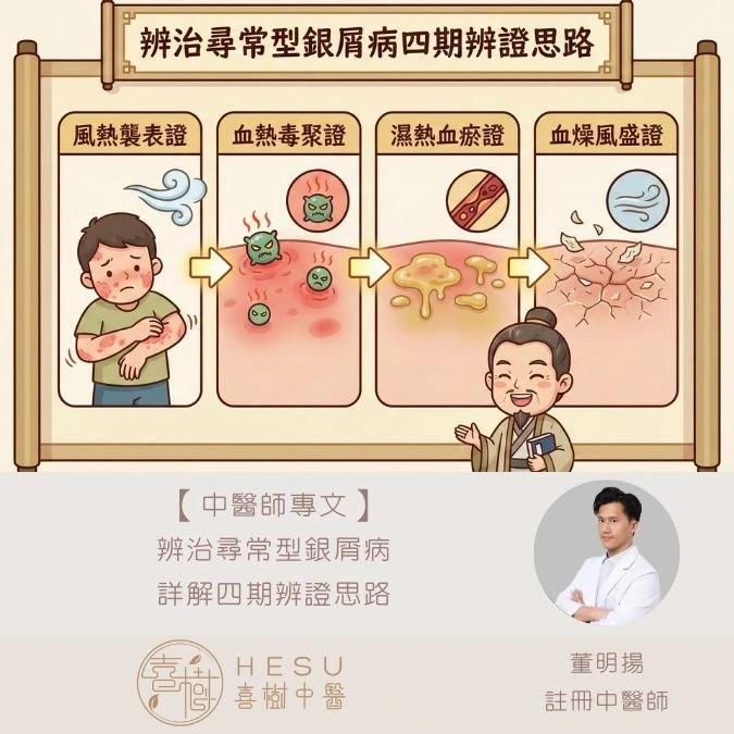 辨治尋常型銀屑病